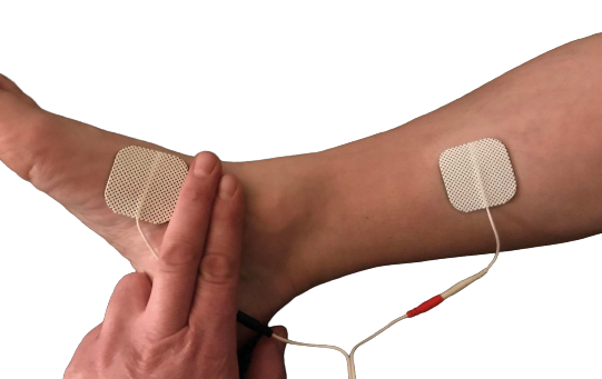 BioLito, медицинский аппарат для лечения недержания мочи и болей в области малого таза — изображение 4